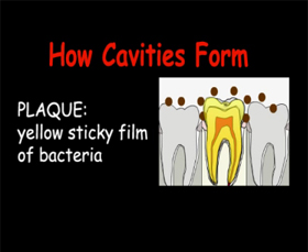The Importance of Flossing Animation